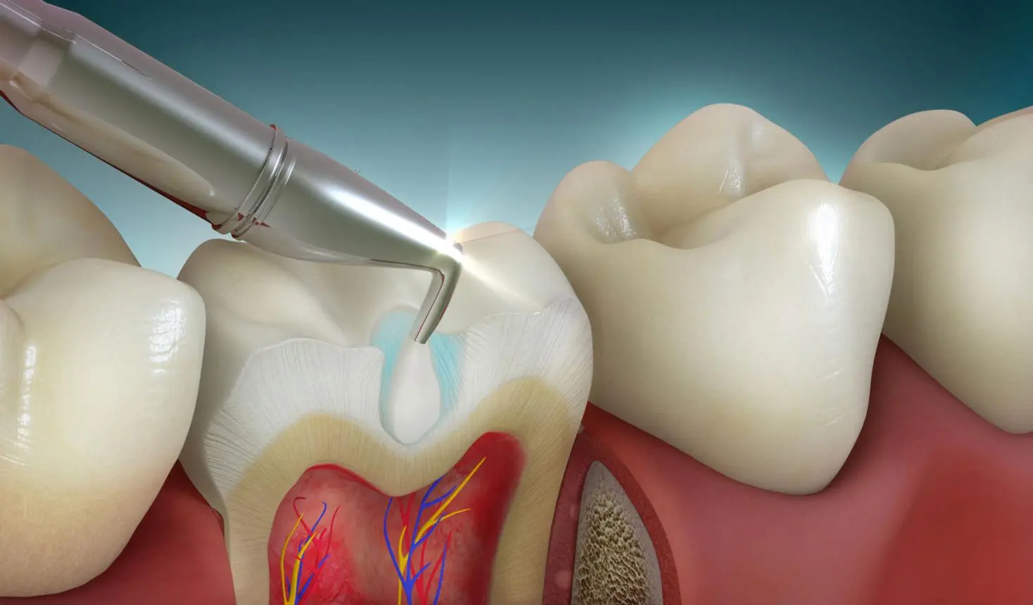 DentLink